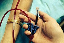 Ozone Hyperauto therapy Ozone Hyperauto therapy