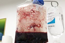 Ozone blood therapy(1) Ozone blood therapy