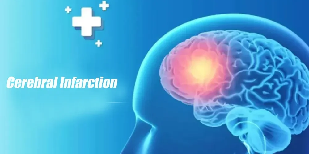 Cerebral Infarction Triple Oxygen Autoblood Therapy - Cerebral Infarction