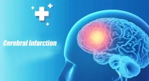 Triple Oxygen Autoblood Therapy - Cerebral Infarction​