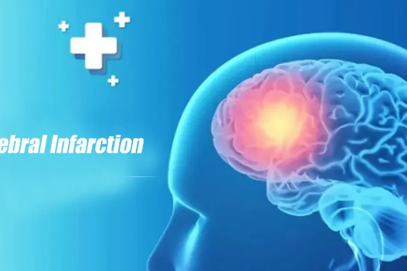 Cerebral Infarction Triple Oxygen Autoblood Therapy - Cerebral Infarction