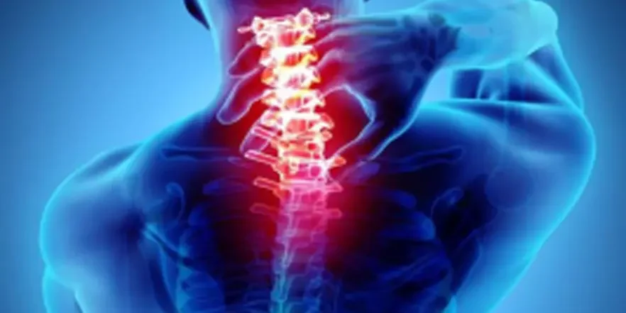 cervical spondylosis Medical ozone injection therapy in cervical spondylosis