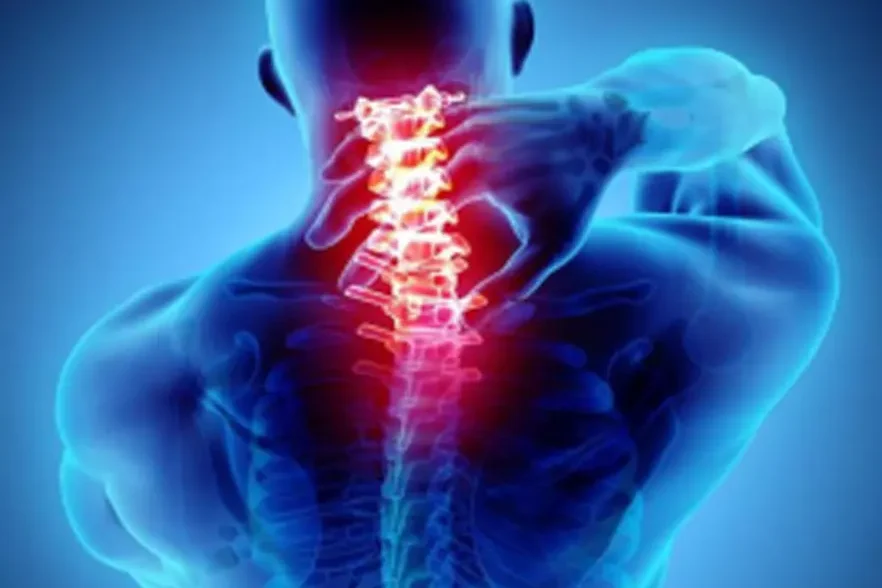 cervical spondylosis Medical ozone injection therapy in cervical spondylosis