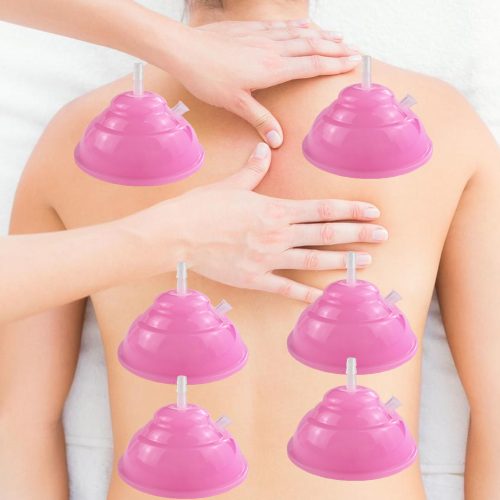 cupping cup